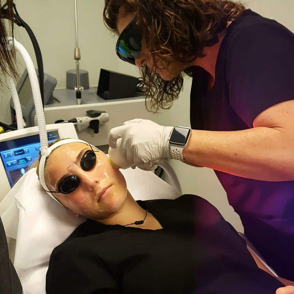 Venus Concepts IPL Facial