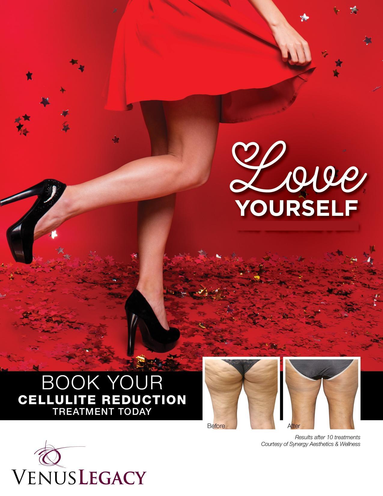 Body Sculpting by InSkin Laser & Body