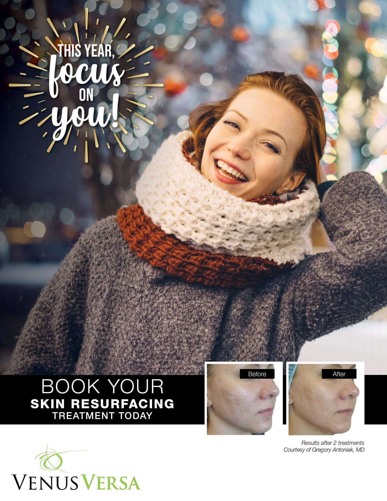 Skin Resurfacing With Venus Versa