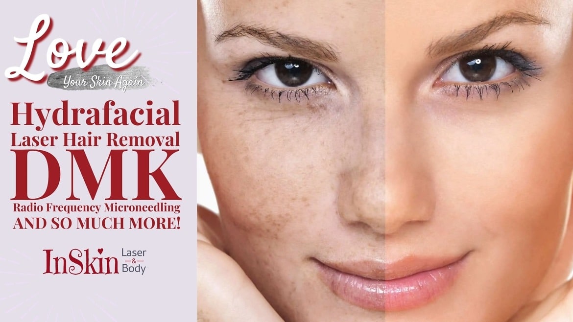 Inskin About Homepage