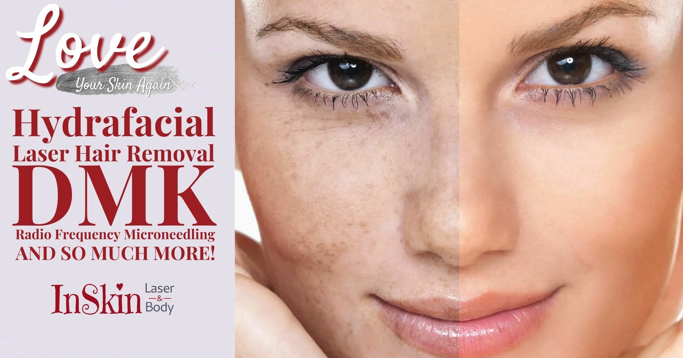 Inskin Hydrafacial Laser hair Removal DMK